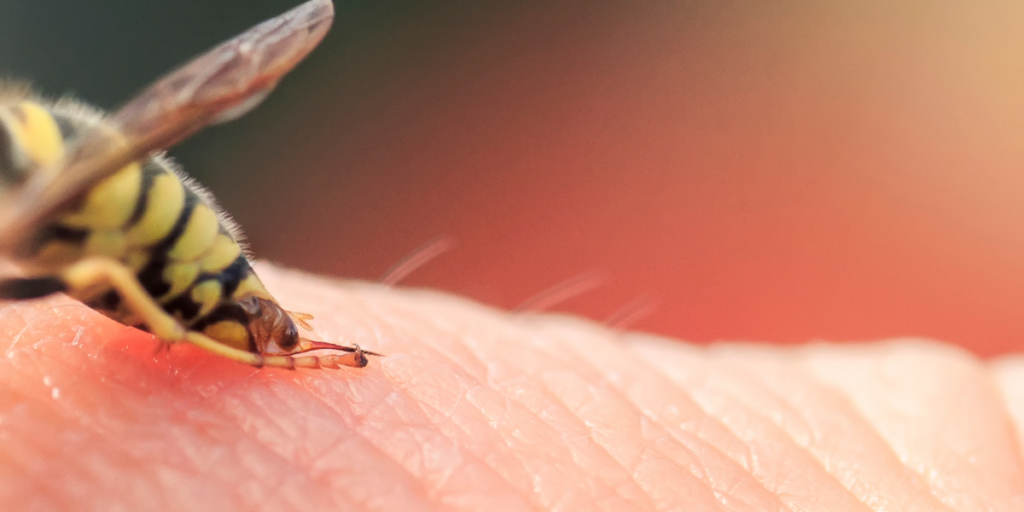 Being Stung By a Wasp